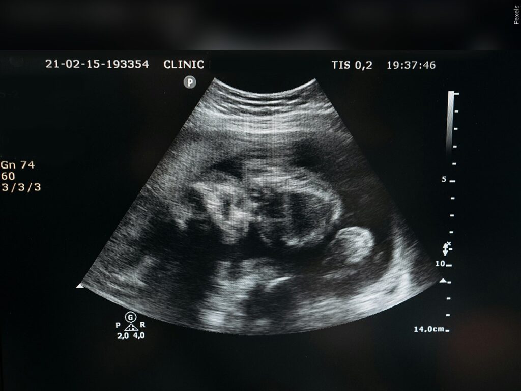 Se reactiva una ley de Nevada que le exige a las menores de edad que se sometan a un aborto, que notifiquen a sus padres