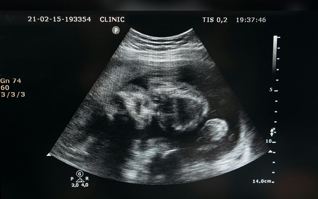 Se reactiva una ley de Nevada que le exige a las menores de edad que se sometan a un aborto, que notifiquen a sus padres