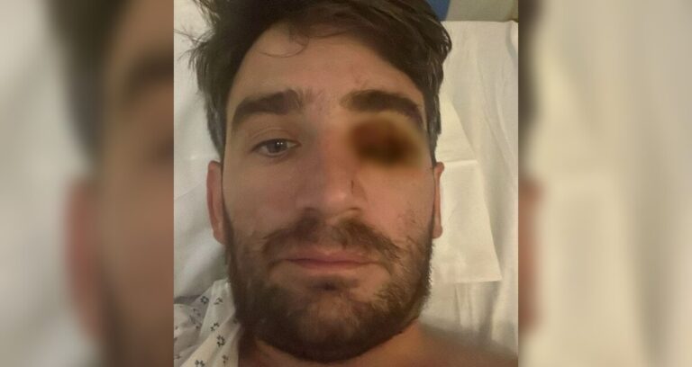 Accidente en Fiesta de Año Nuevo: Hombre Pierde un Ojo por Explosión de Fuegos Pirotécnicos