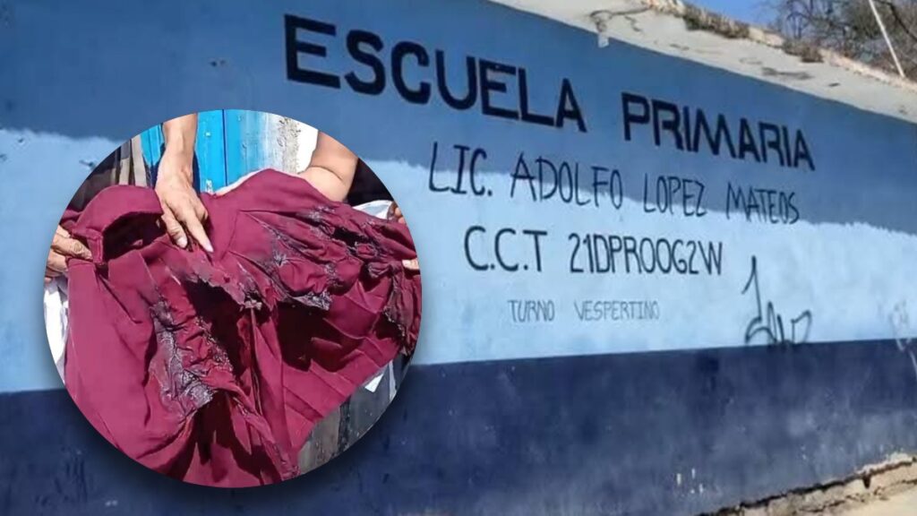 Accidente Escolar en Tehuacán: Alumna de Primaria Se Quema Durante Experimento