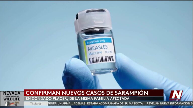 Brote De Sarampión En El Condado Placer