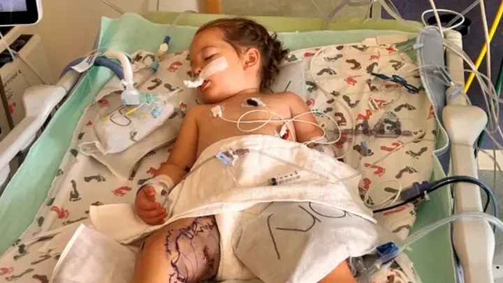 Hospitalizan a Niña de 2 Años en Bennett, Colorado, Tras Mordedura de Serpiente de Cascabel