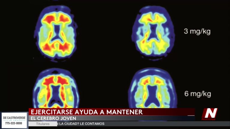 Ejercicio Después De Los 40: Clave Para Frenar El Envejecimiento Del Cerebro