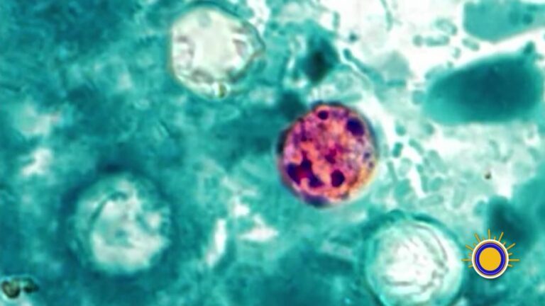 CDC alerta por brote de ciclosporiasis en Estados Unidos: ya suma más de 1,600 casos