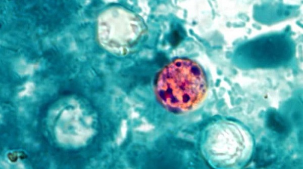 Brote de ciclospora en New Hampshire: investigan casos vinculados a la cafetería del Cheshire Medical Center