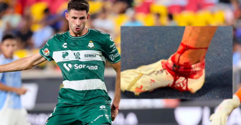 Santos Laguna exigirá respuesta a Concacaf por lesión de Lucas Di Yorio en la Leagues Cup